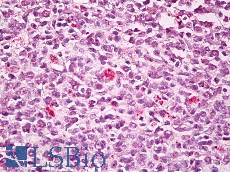 IHC-plus™ SWAP70 Antibody (aa1-50)