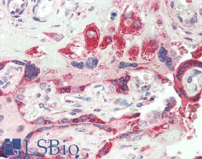 IHC-plus™ Polyclonal Rabbit anti-Human IL1RL1 Antibody (IHC)