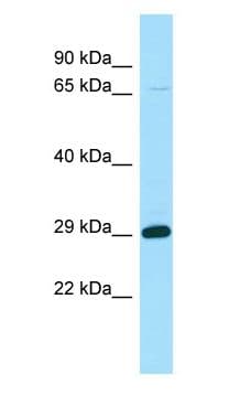 Polyclonal Rabbit anti-Human STARD6 Antibody (N-Terminus, WB)
