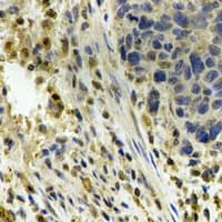 P5CDH / ALDH4A1 Antibody