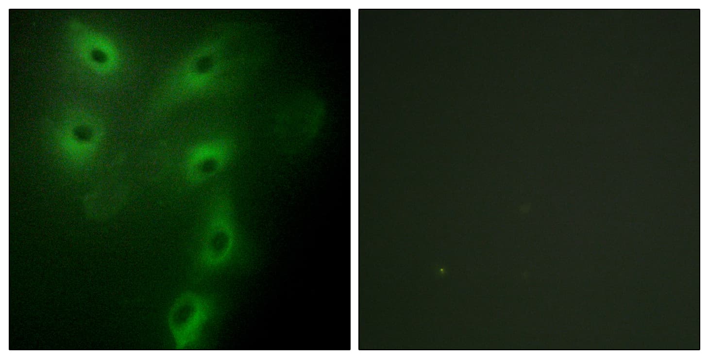 IHC-plus™ Polyclonal Rabbit anti-Human TRIM59 Antibody (aa191-240, IHC, IF, WB)