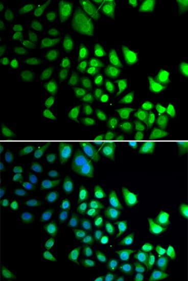 Polyclonal Rabbit anti-Human RBBP5 Antibody (IHC, IF, WB)