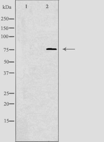 ANOS1 / Anosmin Antibody