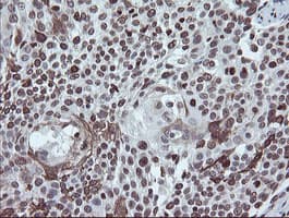 CHN1 Antibody (clone OTI2G6)