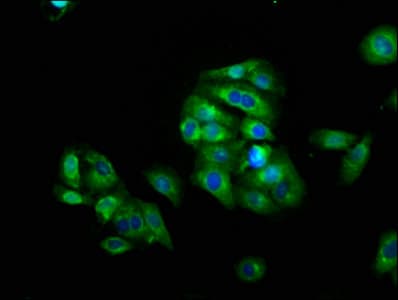 Polyclonal Rabbit anti-Human LAG3 Antibody (aa29-450, WB)