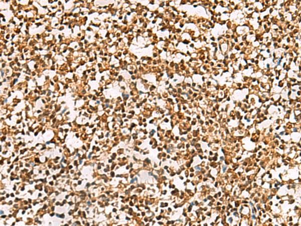Polyclonal Rabbit anti-Human PHF5A / INI Antibody (IHC, WB)