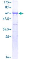 Human GAPDH Protein (Recombinant GST)