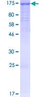 Human PACS2 Protein (Recombinant GST)