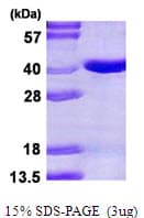 Human Pirin / PIR Protein (Recombinant His)