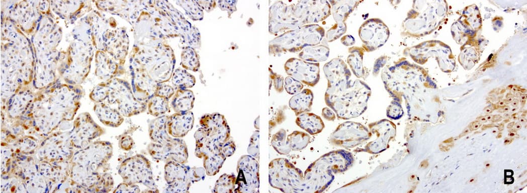 PSMA6 Antibody (clone UMAB102)