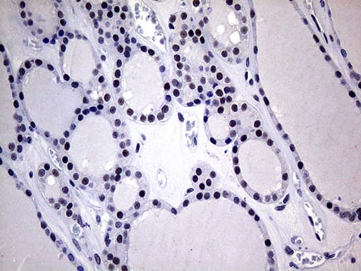 Monoclonal Mouse anti-Human WTAP Antibody (clone OTI6C3, Carrier-free, aa2-106, IHC, WB)