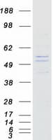 Human KLHDC7B Protein (Recombinant Myc-DDK (Flag))