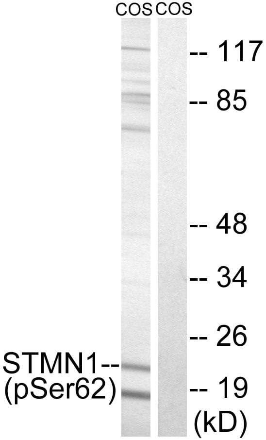 STMN1 / Stathmin / LAG Antibody (phospho-Ser62)