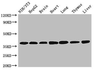 IHC-plus™ LDHC / Lactate Dehydrogenase C Antibody