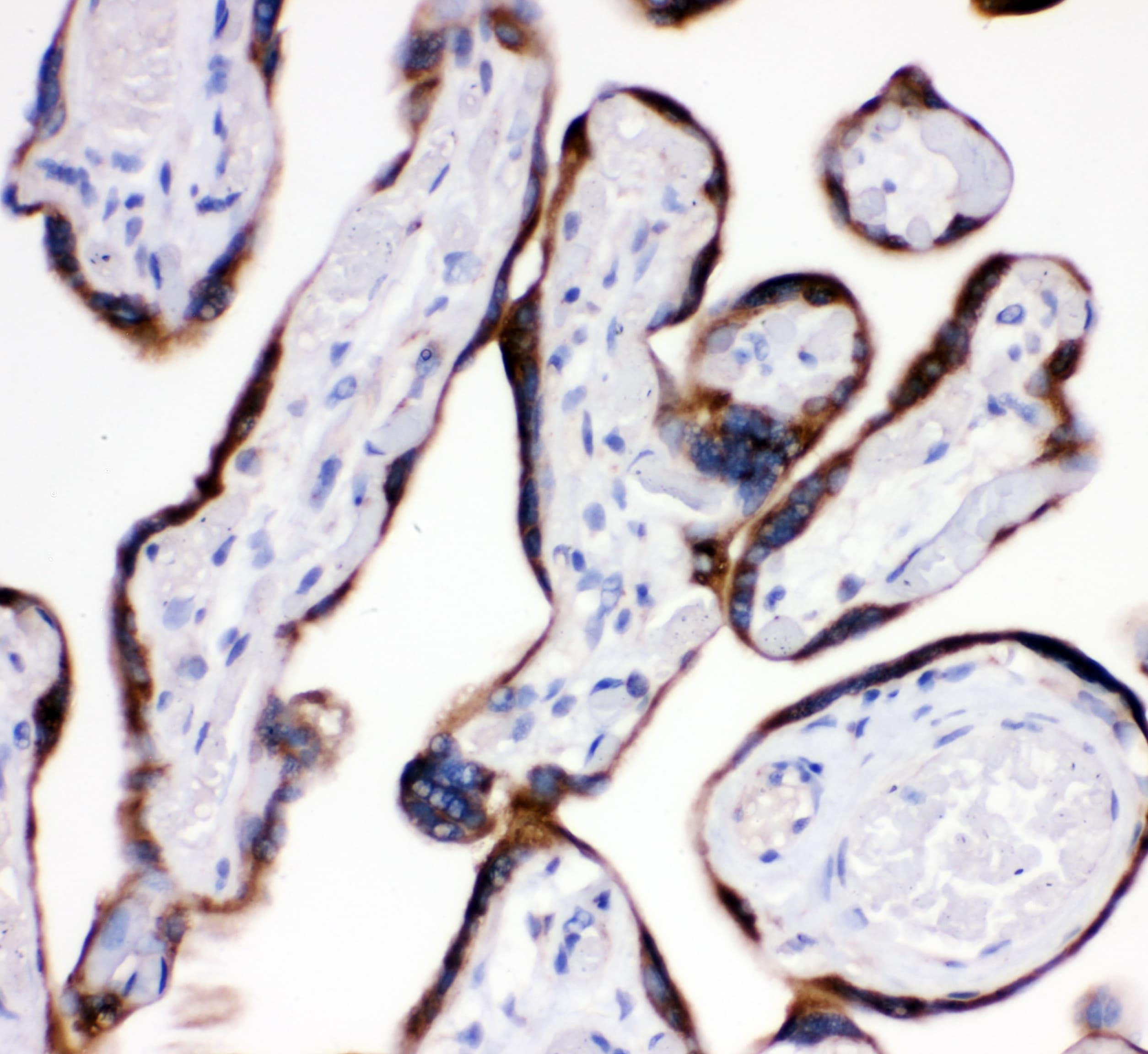AEBP2 Antibody
