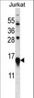 MLC2 / MYL9 Antibody (aa96-125)