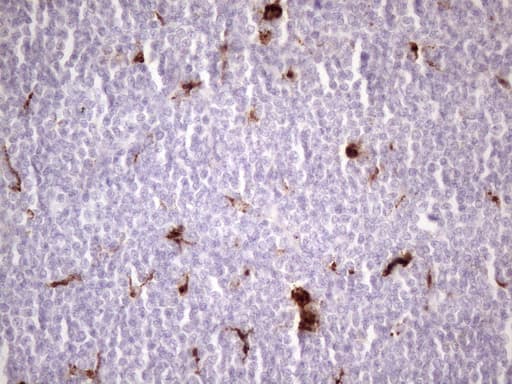 NR2C2 / TAK1 Antibody (aa1-241, clone OTI1B1)