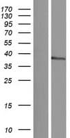 NKX1-2 Protein (Over-Expression Lysate Myc-DDK (Flag))