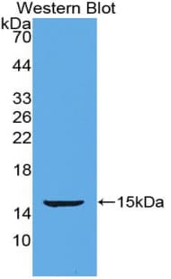 POSTN / Periostin Antibody (aa370-494)