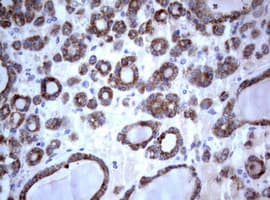 PIK3C2A Antibody (aa230-560, clone OTI4H9)