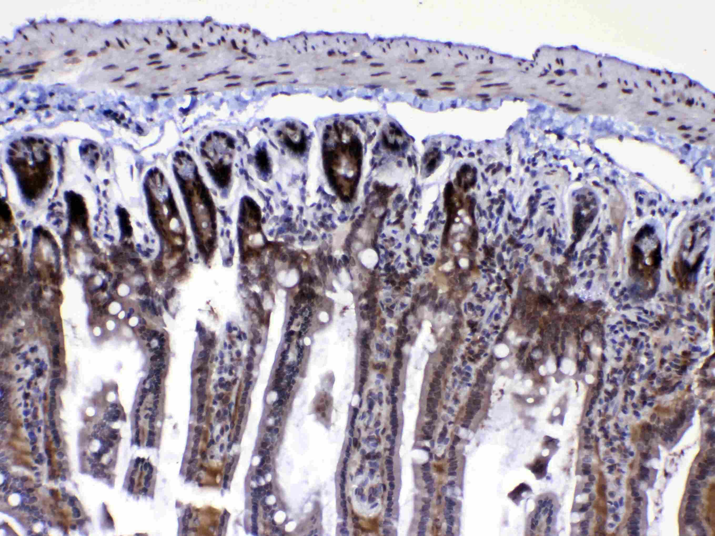 RAN Antibody