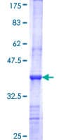 Human LGI3 Protein (Recombinant GST, N-terminus)