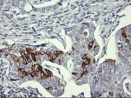 SYP / Synaptophysin Antibody (clone OTI1G3)