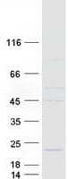 Human TMEM229B Protein (Recombinant Myc-DDK (Flag))