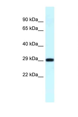 Polyclonal Rabbit anti-Human RPS4X + RPS4Y1 + RPS Antibody (C-Terminus, WB)