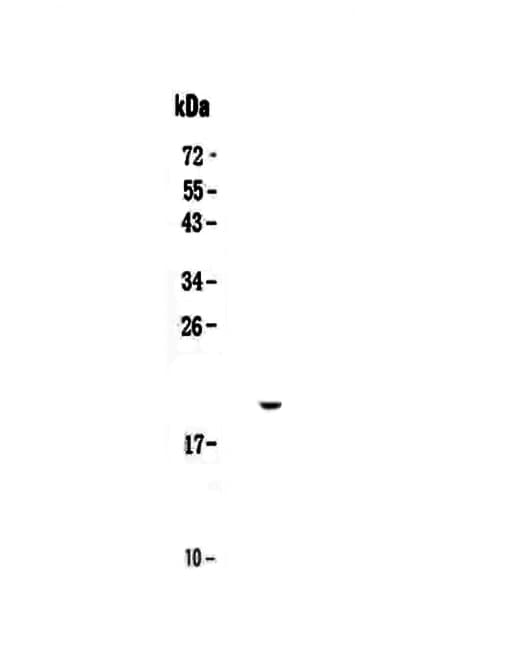 Polyclonal Rabbit anti-Mouse IL17C Antibody (WB)