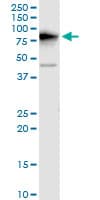 DDX3Y Antibody (clone 2D7)