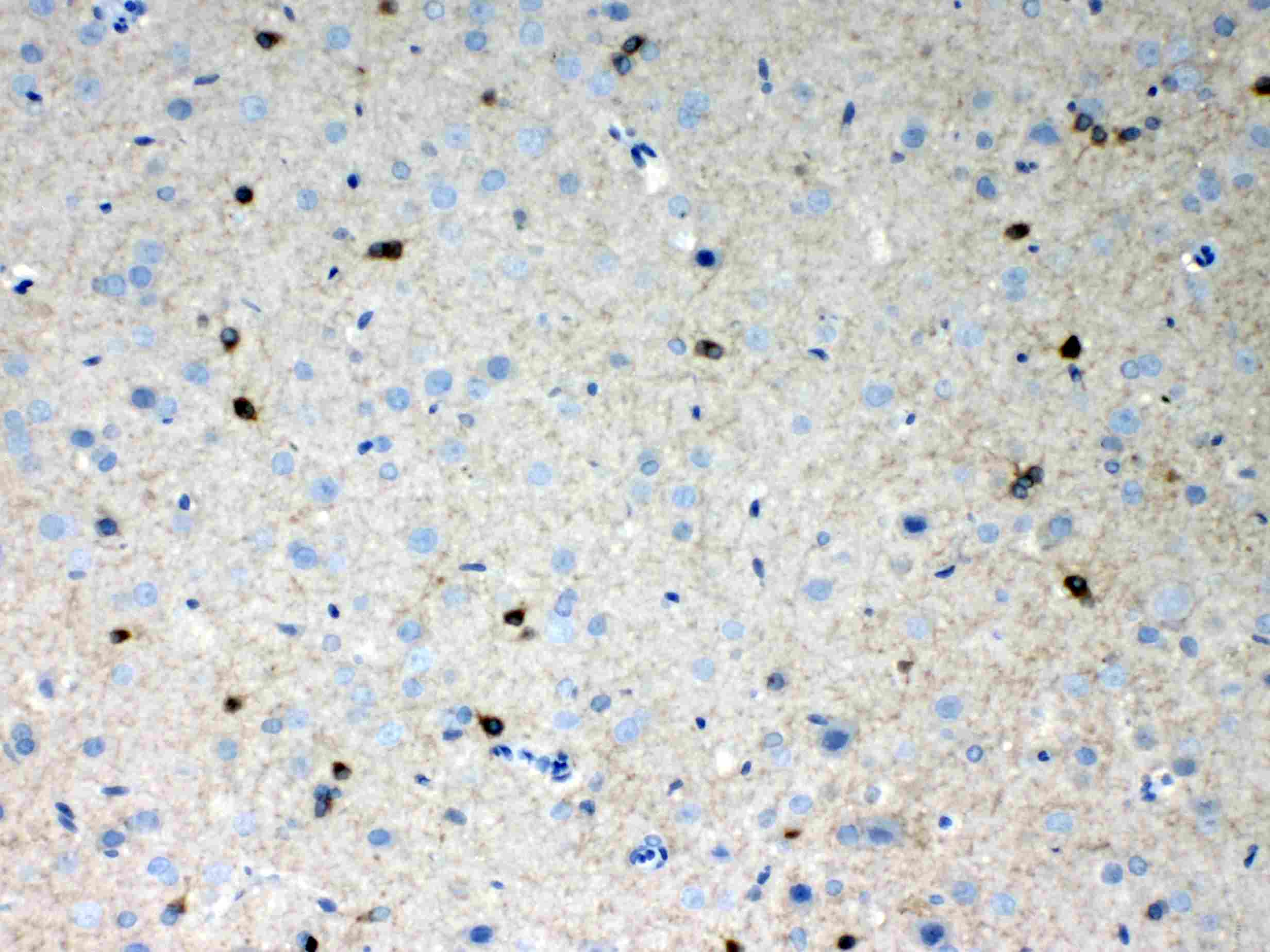 HCN2 Antibody