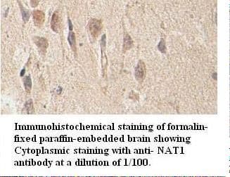 NAT1 / AAC1 Antibody