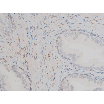 GATA1 Antibody (phospho-Ser142)