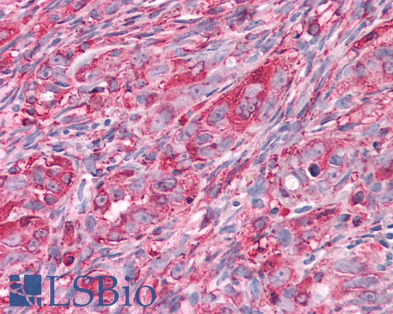 PathPlus™ CHRM3 / M3 Antibody (C-Terminus)