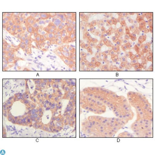 KRT5 / CK5 / Cytokeratin 5 Antibody