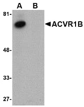 IHC-plus™ Polyclonal Rabbit anti-Human ACVR1B / ALK4 Antibody (IHC, WB)
