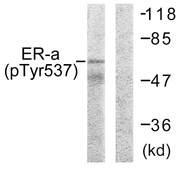 Polyclonal Rabbit anti-Human ER Alpha / Estrogen Receptor Antibody (phospho-Tyr537, IHC, WB)