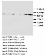 GRIN1 / NMDAR1 Antibody (N-Terminus)
