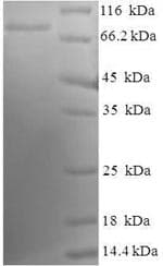 Human LDB3 / ZASP Protein (Recombinant GST, N-terminus)