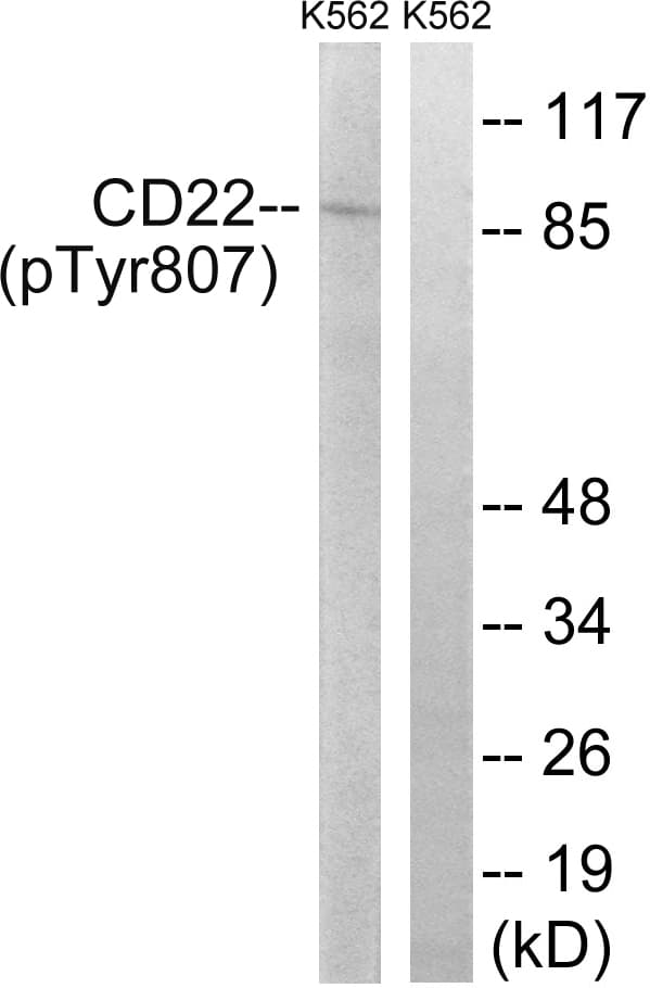CD22 Antibody (phospho-Tyr807)