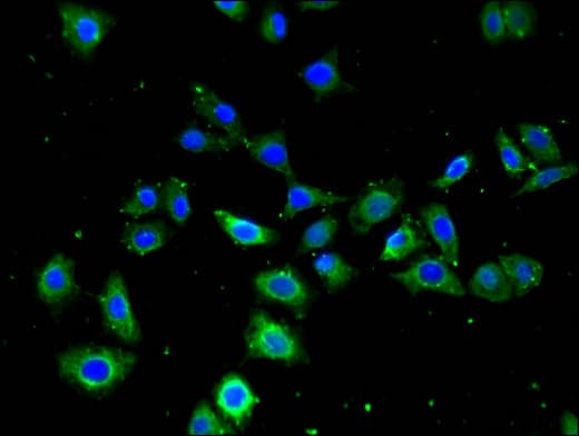 FZD4 / Frizzled 4 Antibody
