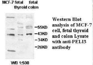 PELI3 / Pellino 3 Antibody (aa52-299)