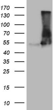 VPS13B Antibody (aa91-346, clone OTI6D1)