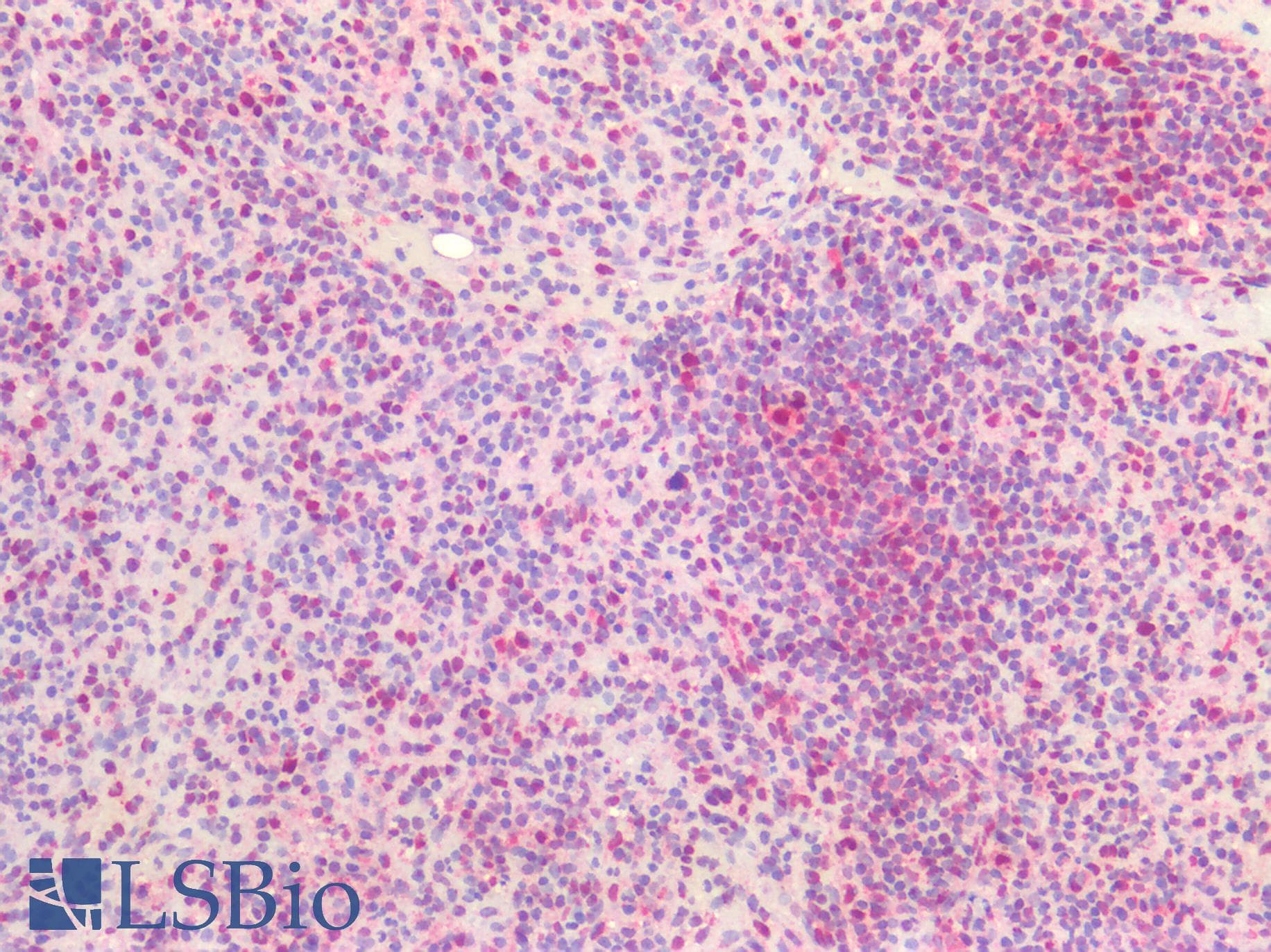 PathPlus™ Polyclonal Rabbit anti-Human BAD Antibody (IHC, WB)