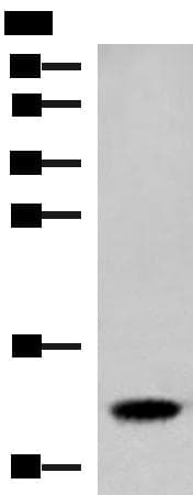 Polyclonal Rabbit anti-Human HBE1 / Hemoglobin Epsilon 1 Antibody (IHC, WB)