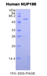Human NUP188 Protein (Recombinant His-GST)