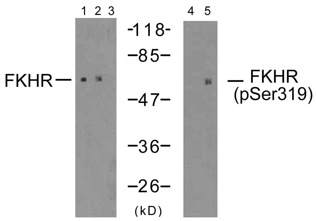 Polyclonal Rabbit anti-Human FOXO1 / FKHR Antibody (p319, IHC, WB)