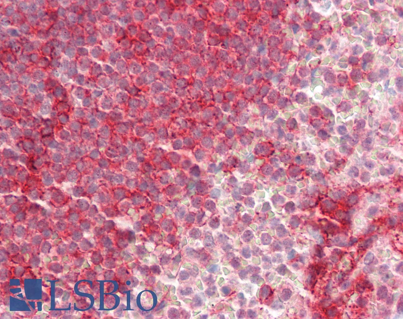 IHC-plus™ ITGAL / CD11a Antibody (aa722-751)
