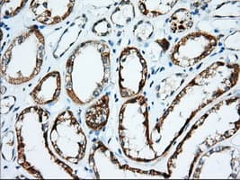 IGF2BP2 Antibody (clone OTI3G7)